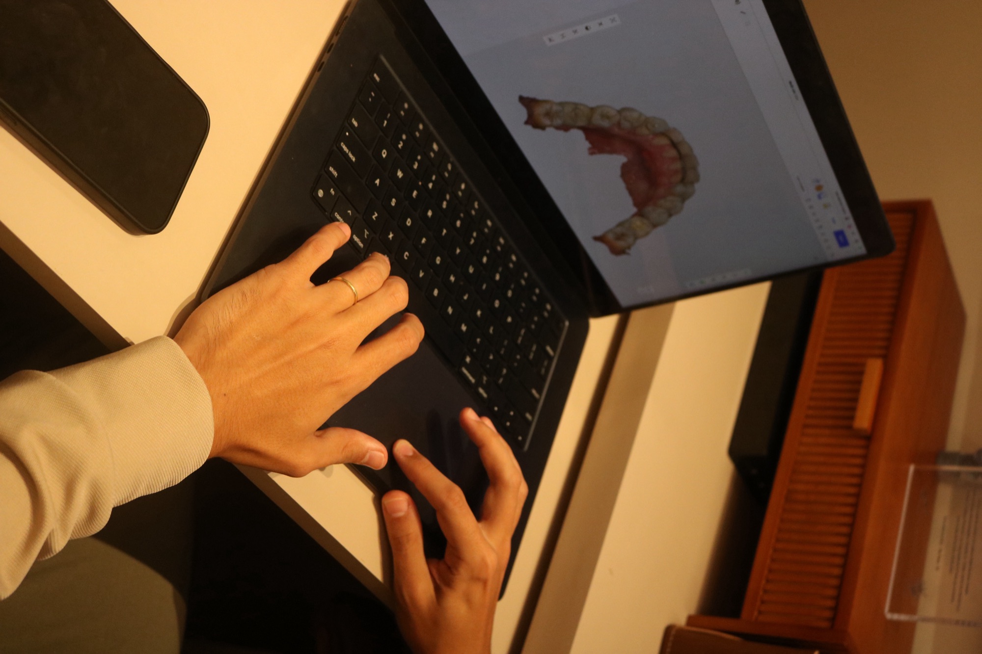Escaneamento 3D do sorriso na inclinic