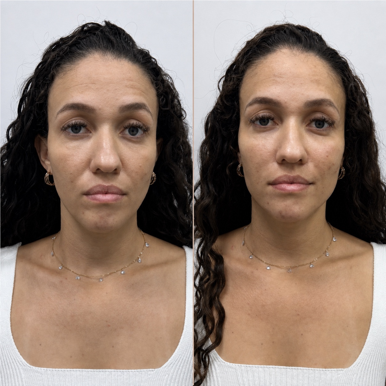 Resultado de tratamento, Maria Clara Marques