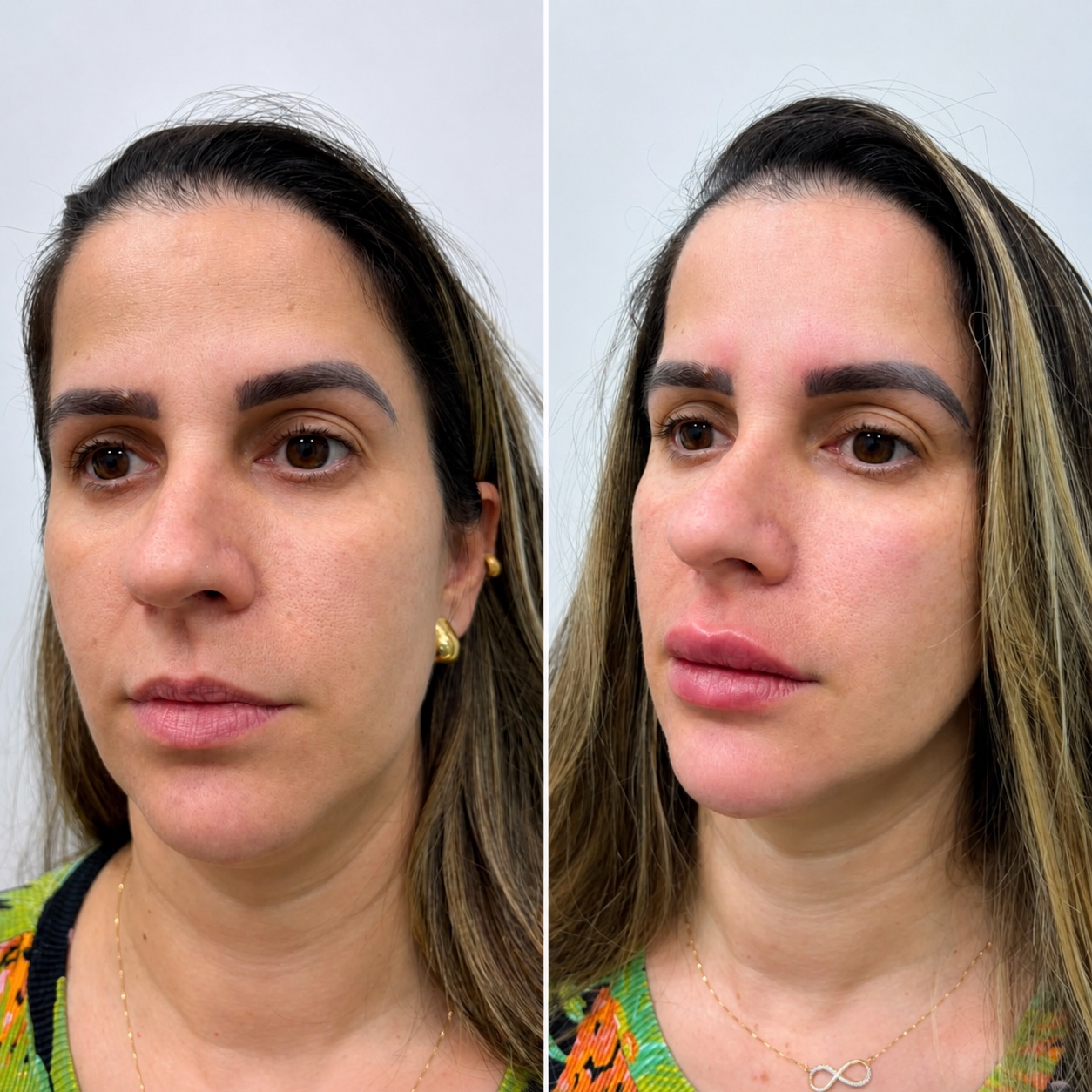 Resultado de tratamento, Maria Clara Marques
