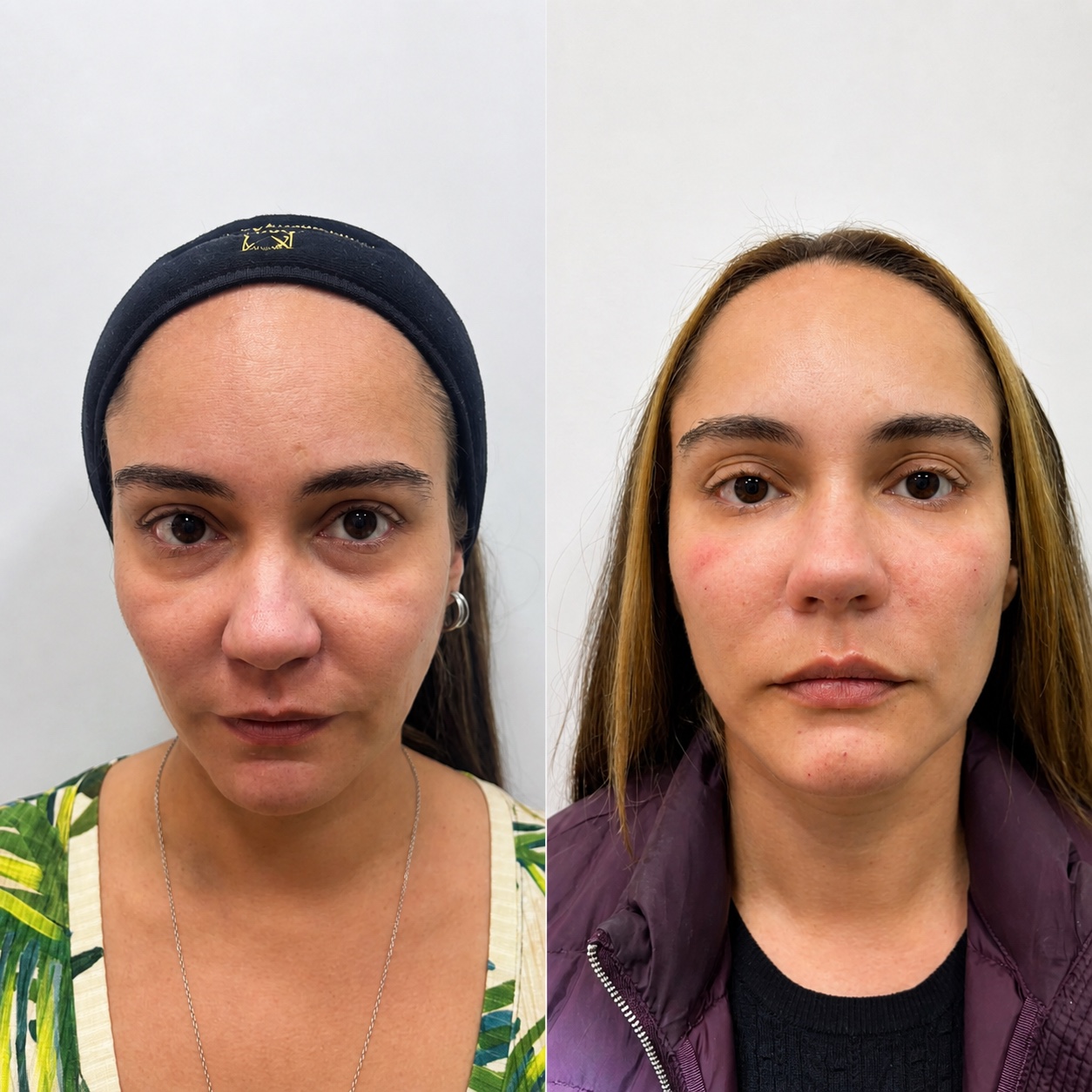 Resultado de tratamento, Maria Clara Marques